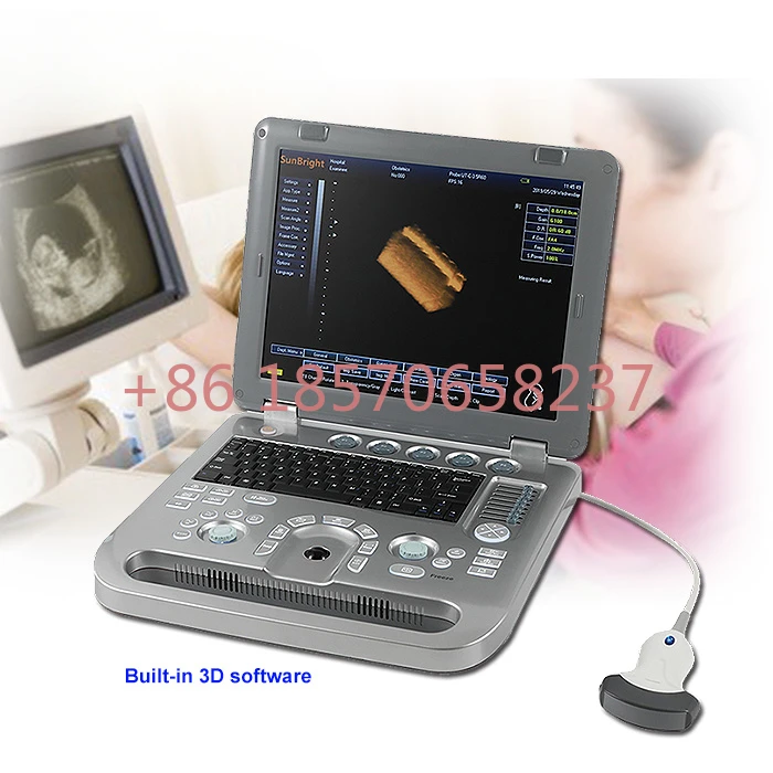 

New veterinary use 3d mobile ultrasound