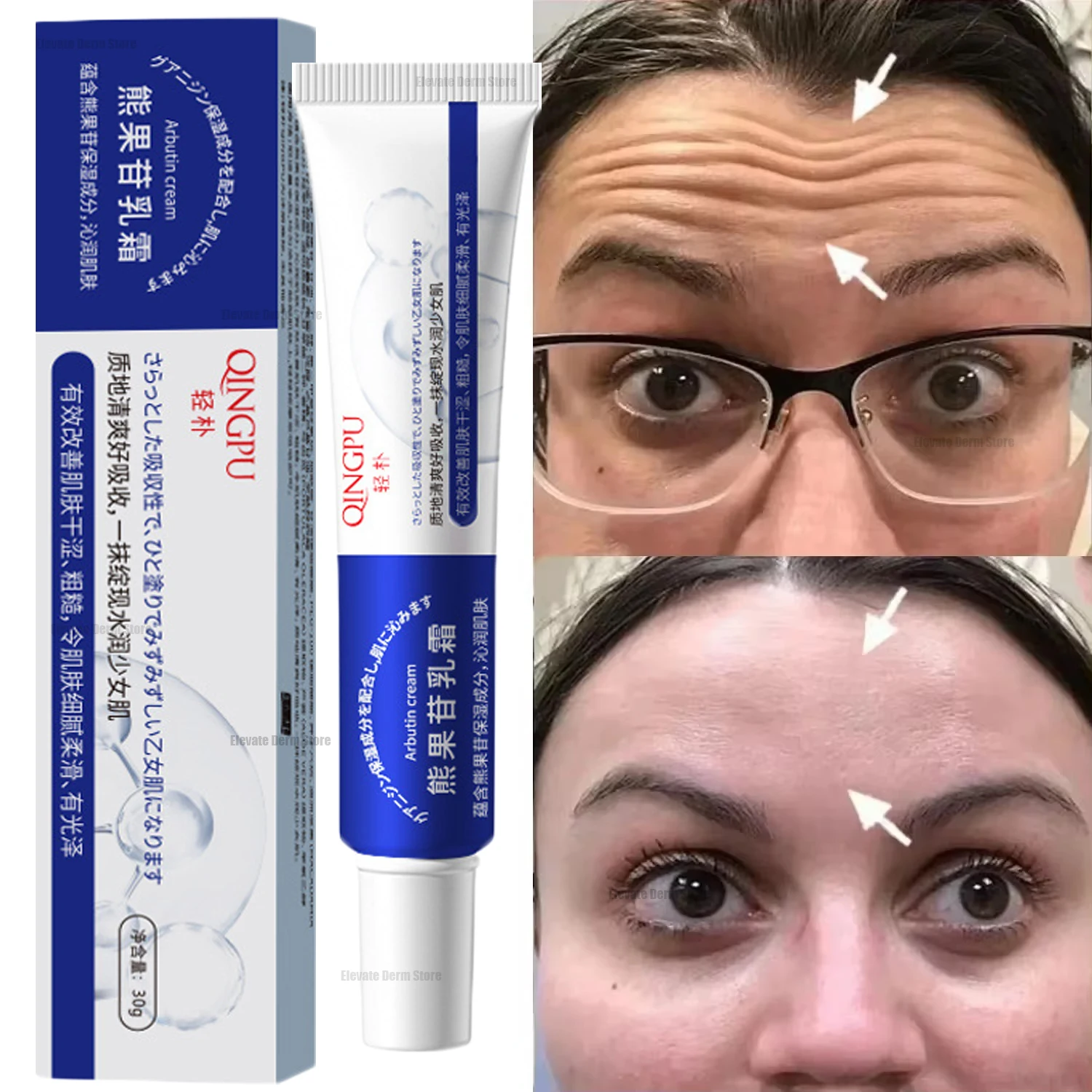 Nicotinamide Whitening Cream Face Remove Dark Spot Freckles Fade Melanin Retinol Anti-wrinkle Cream Brightening Korean Skin Care 1