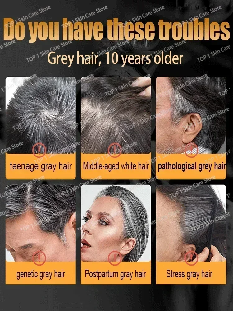 Anti Gray  Hair Serum  White To Black Natural Repair Product 1 3