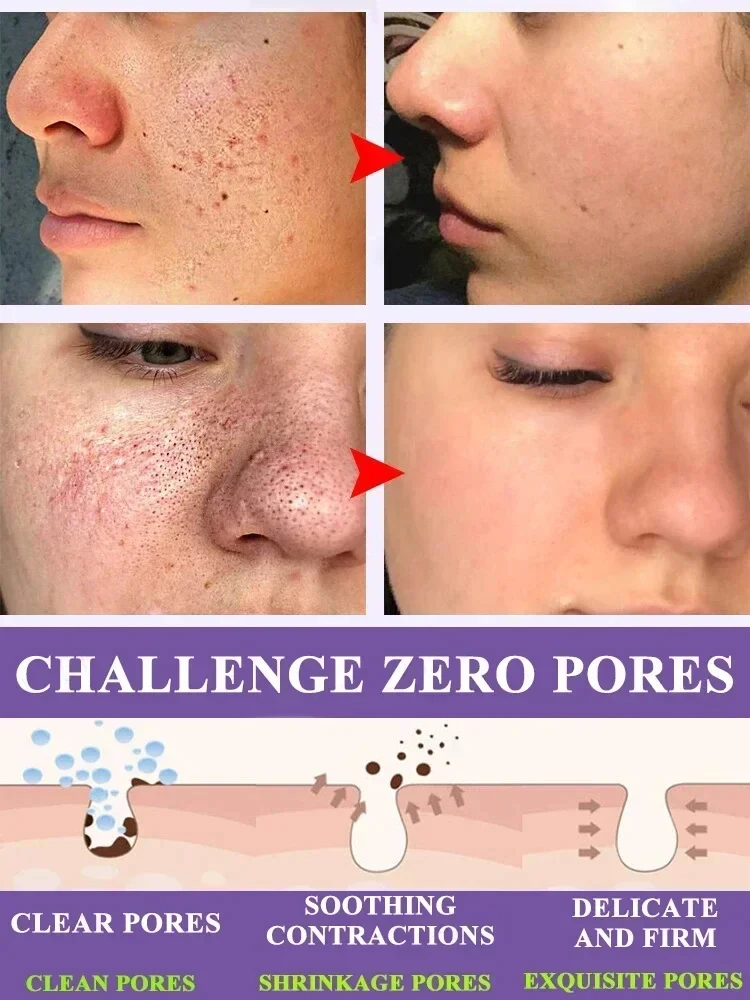 Lactobionic Acid Pore Shrink Face Serum Hyaluronic Acid Moisturizing Nourishing Essence Firming Brighten Beauty Korean Cosmetics 3
