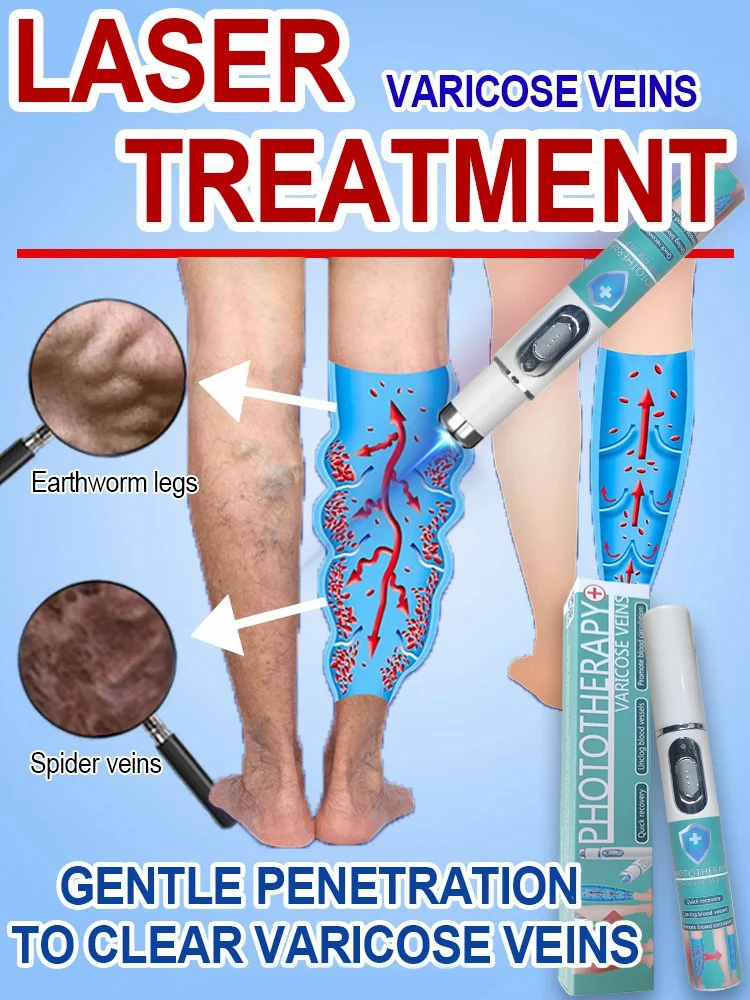 Vein Laser