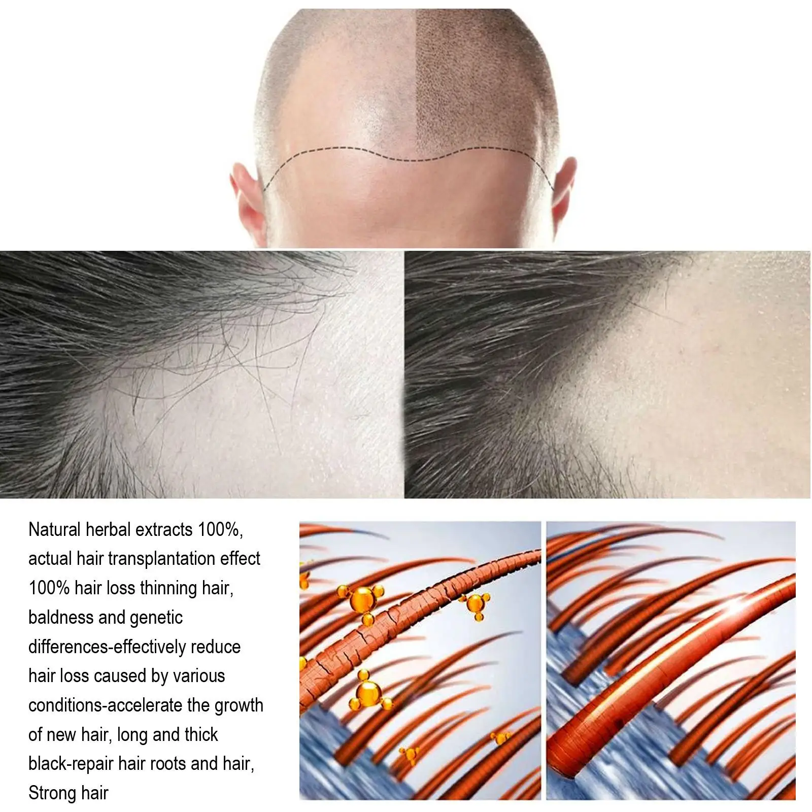 10PCS Biotin Schnelles Öl Haarwachstumsserum Haarverdünnungsbehandlung Flüssigkeit Anti-Haarausfall für Frauen und Männer_voghion.com