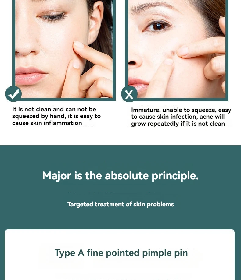 Acne Blackhead Needle Set Image 4