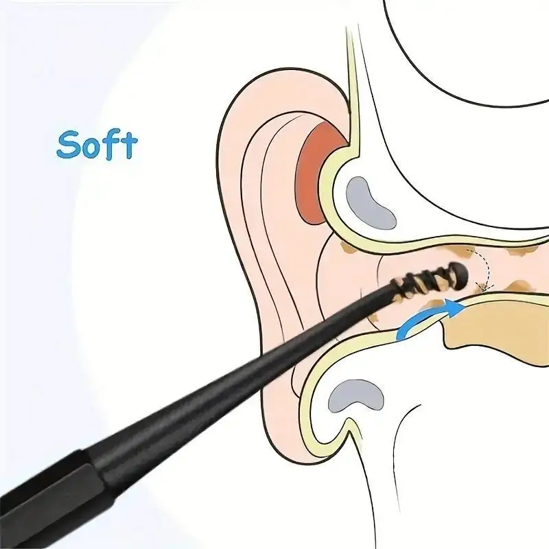 2pc Spiral Ear Spoon Double Headed Rotating Ear Digging Tool