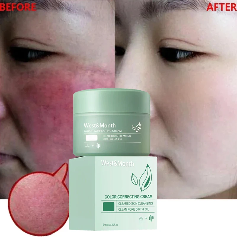 Redness Repair Cream Relieve Sunburn Improve Dullness Whitening Skin Tone Corrector Strengthen Sensitive Anti Dark Spots Lotion sunburn