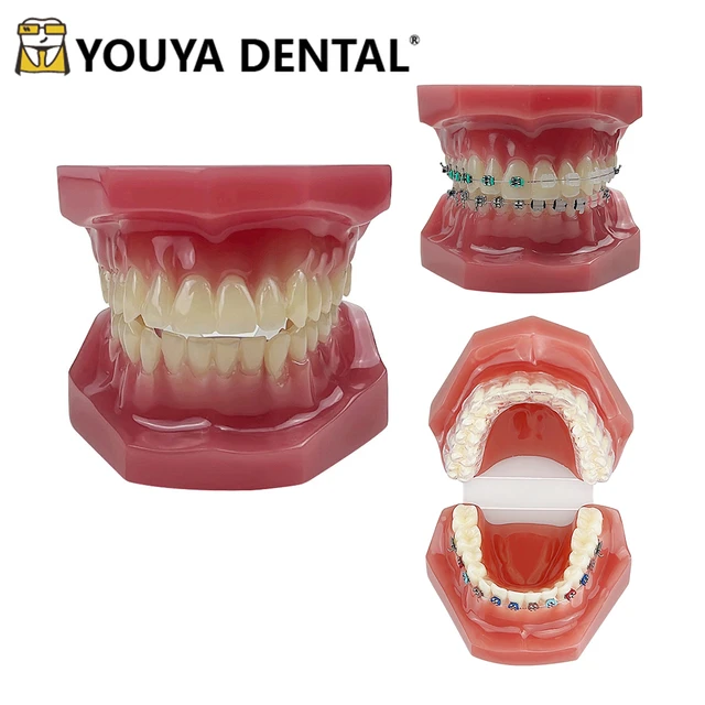 Gum Machoire - Dentier D'apprentissage - AliExpress