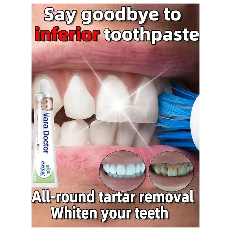Dental Calculus Remover Whitening Teeth Mouth Odor Removal Bad Breath Preventing Periodontitis Oral Health Care