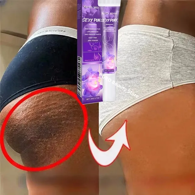 Crème éclaircissante à la nicotinamide pour peau foncée, efficace, éclaircir l'intérieur de la cuisse Wiltshire ach, enlever la mélanine, parties intimes, éclaircir 1