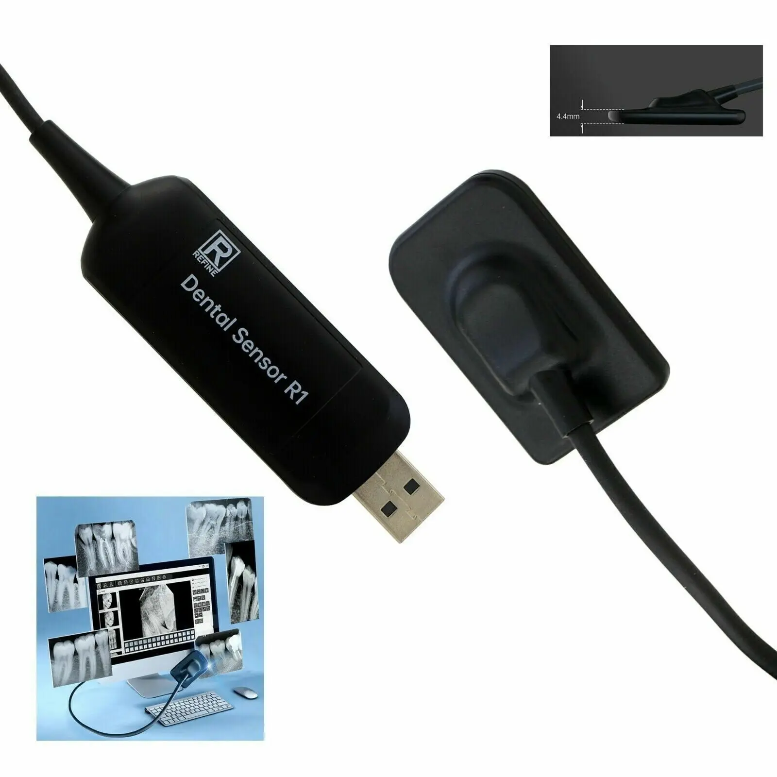 

Высококачественная цифровая система внутриоральной визуализации Usb2.0, стоматологический датчик Rvg, датчик рентгеновского излучения, стоматологический датчик