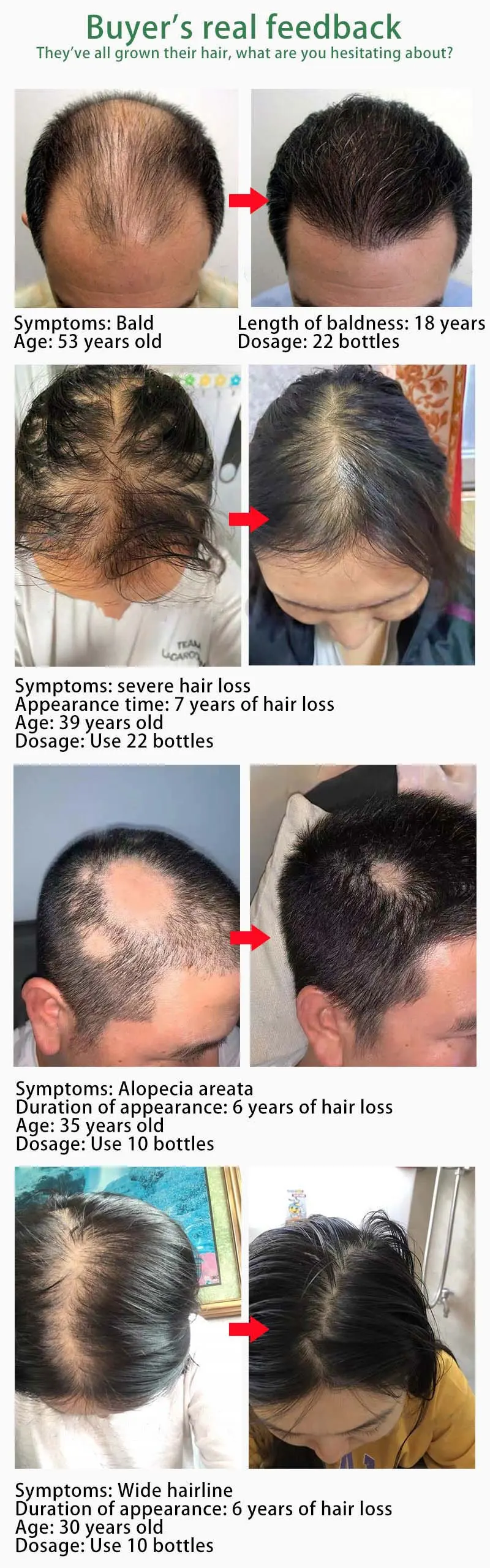 Description Picture 6 of itemHair Growth Oil Fast Hair Growth Effective Baldness Repair Hereditary Hair Loss Postpartum Hair Loss Seborrheic Hair Loss