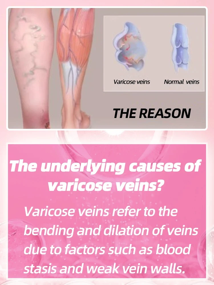 Varicose Vein Laser fractional co2 laser machine