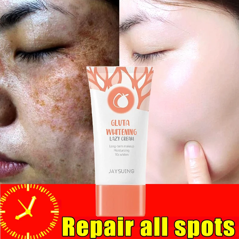 

Effective Remove Spot Cream Whitening Light Spots Repair Dull Fade Melanin Fast Brightening Moisturize Products Korean Cosmetics