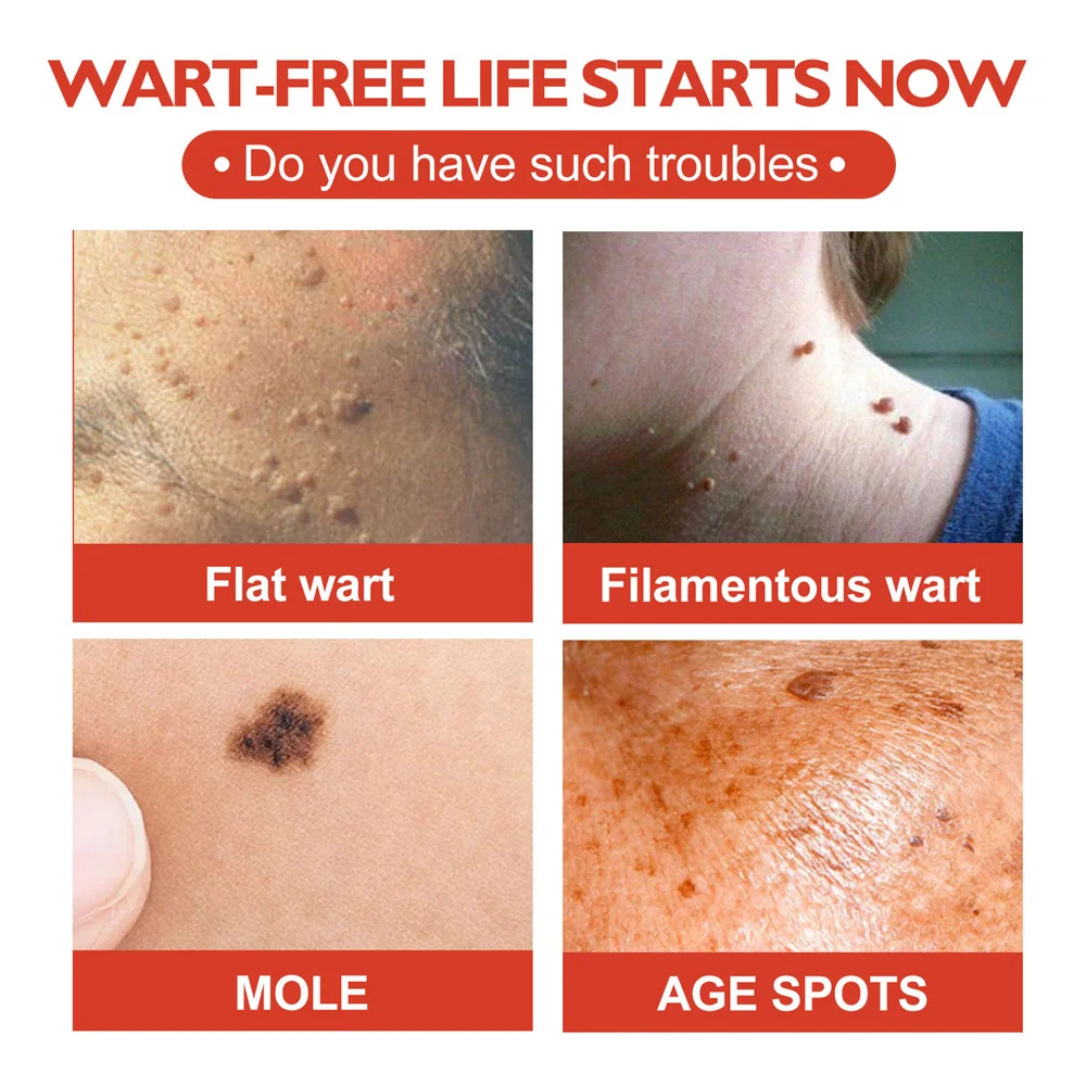 Acne Master Hydrocolloid Patches Image 4