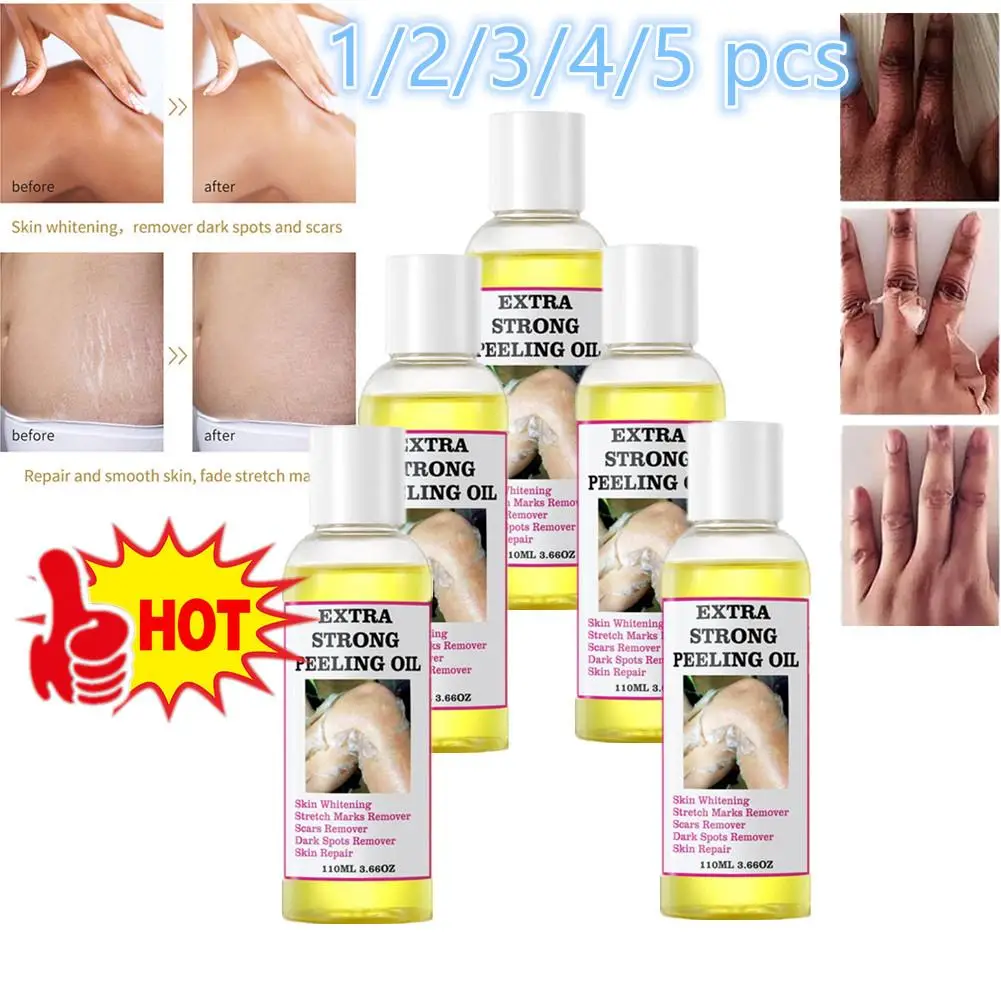 Lot Peeling Oil For Dark Skin Super Strength Yellow Peeling Oil Strong Peeling Oil For Skin Brightening Moisturizing Removes Dea the strength of the strong сила сильных на англ яз