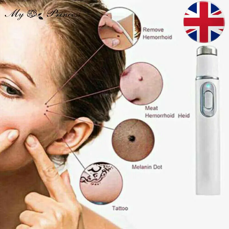 Acne Laser Pen Skin Spots Removal Pen Anti Varicose Spider Vein Eraser
