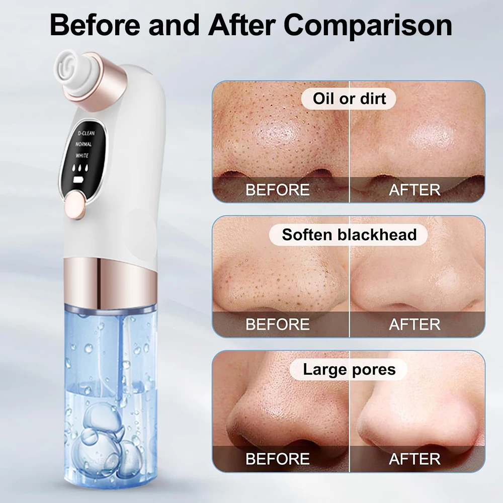 Electric Blackhead Remover Pore Vacuum Cleaner Facial Black Dots Vacuum Cleaner Pimple Acne Blackhead Removal Black Dots Remover 6