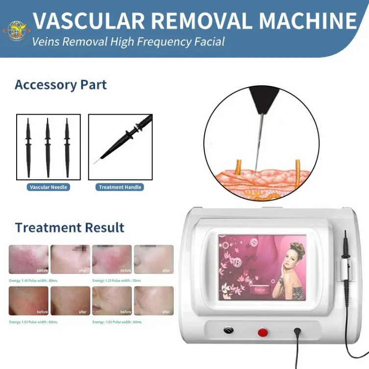 

Rbs Vascular Spider Vein Fungus Remova R-F High Frequency Machine Beauty Equipment
