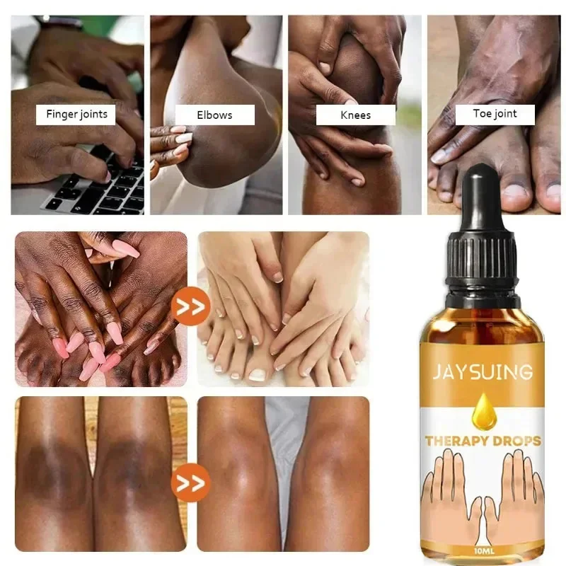 Dark Knuckles Fast Brighten Serum Elbows Hands Knee Armpits Brightening Serum Clarify Black Skin Lighten Stains Remover Essence 3