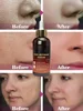 Pore Shrinking Essence Contraction Minimizer Pores Oil Control Eliminate Dilated Pore Remover Face Skin Care Serum 3