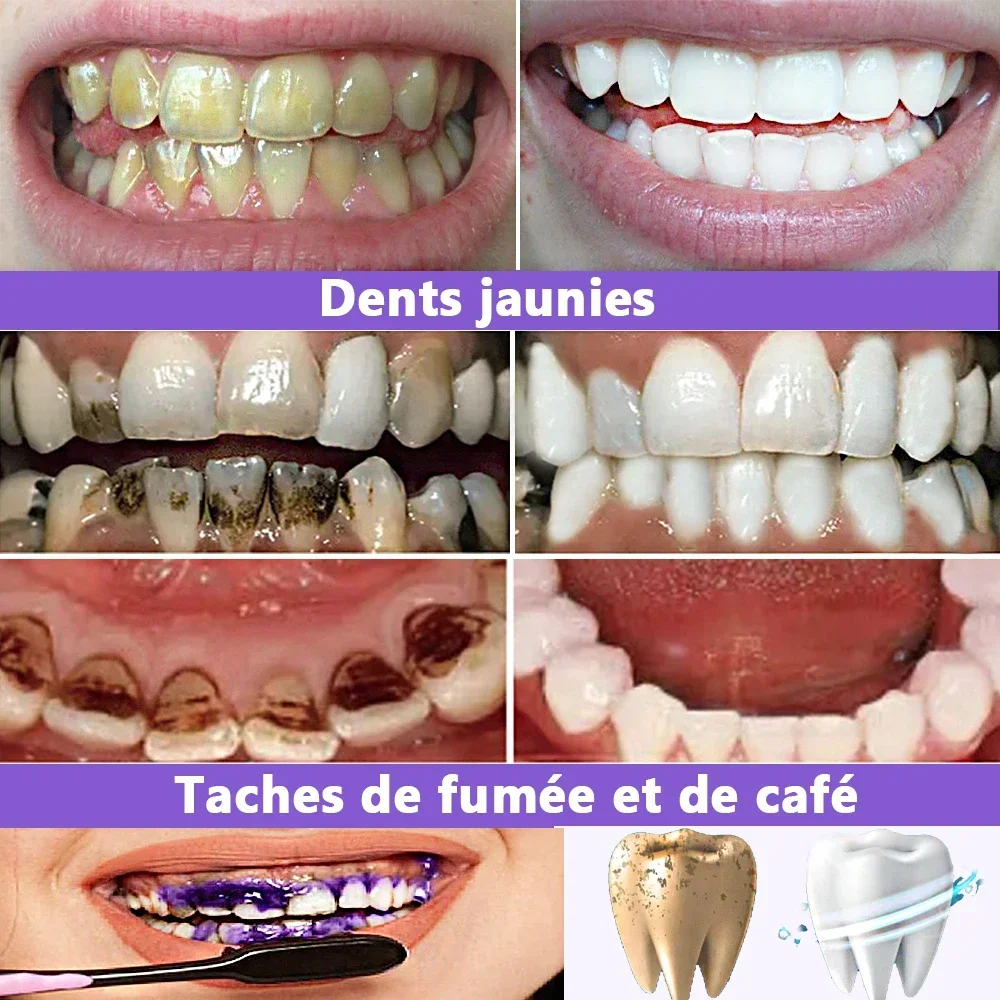V34 Purple Whitening Toothpaste Remove Yellow Stains Gel Dental Plaque Bleaching Cleaning Oral Hygiene Brighten Tooth Care Tools teeth whitening product teeth whitening essence teeth health product