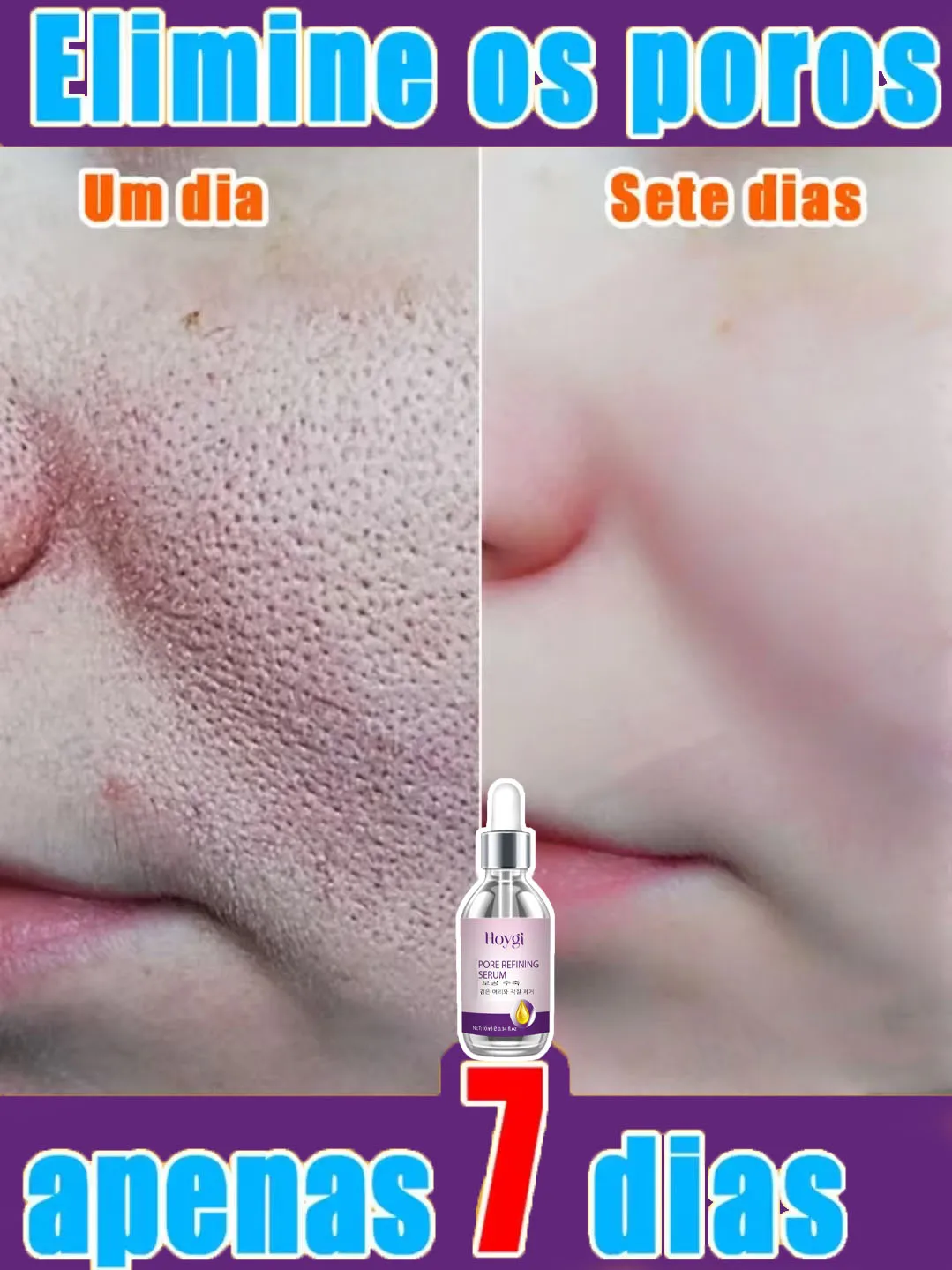 Textura de la piel refinamiento de los poros y regeneraci&oacute;n esencia facial sin acn&eacute;