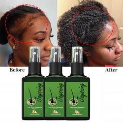 Natural Ginger Hair Growth Spray Hair Roots Fast Grow Anti Hair Loss Serum Liquid Scalp Damaged Treatment Repair Beauty Health
