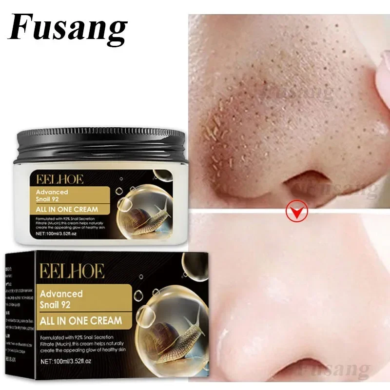 

Acne Remover Improve Blackheads Oil Control Cream Pore Shrinking Moisturizing Repair Cream Reduce Blemishes Advanced Snail Cream