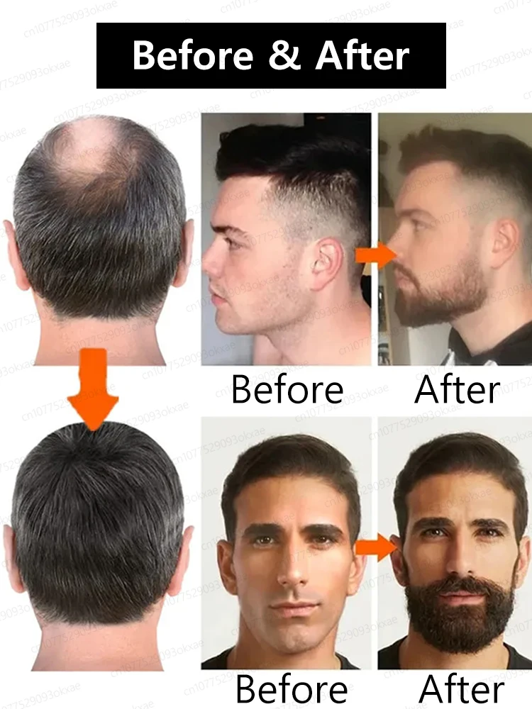 Beard Growth Serum Fast Styling Thicker Longer Fuller Beard Softening 3