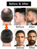 Beard Growth Serum Fast Styling Thicker Longer Fuller Beard Softening 3