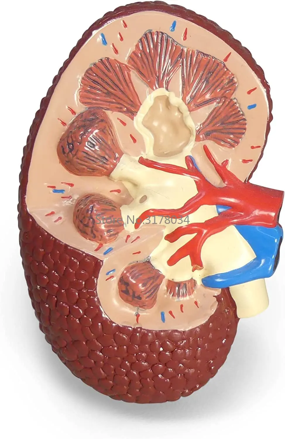Type II Diabetes Model Set 4