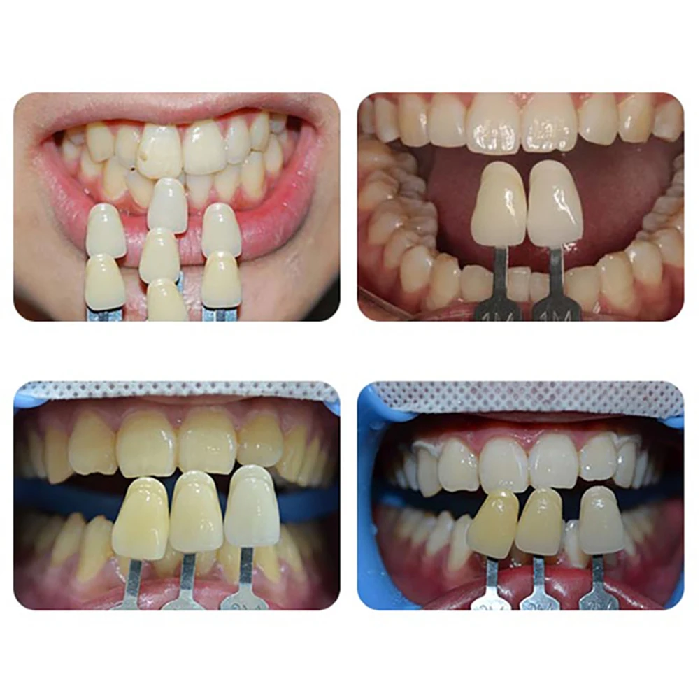 Vita 3D Master Dental Lab Bleach Shade Guide 29 Colors Teeth Whitening Comparing Toothguide Dentistry Cic Colorimetric_voghion.com