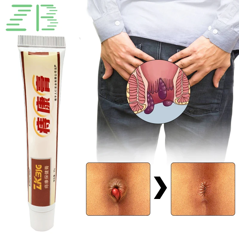 Hemorrhoids Treatment Cream Hua Tuo Hemorrhoid Cream Piles Elimination Pain Anal Bleeding Musk Herbal