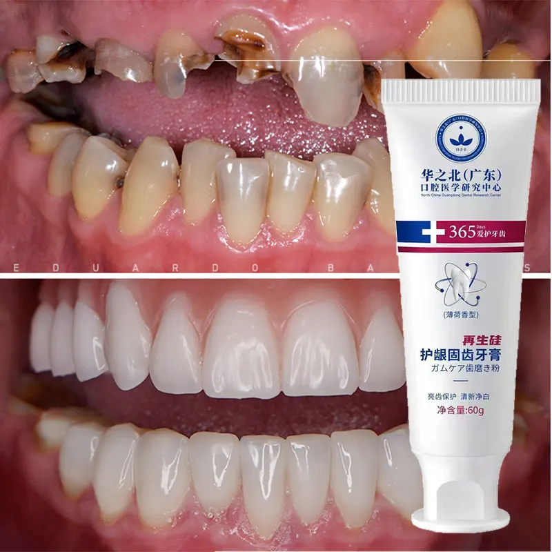 New Upgrade Quick Repair of Cavities Caries Removal of Plaque Stains Decay Whitening Yellowing Repair Teeth Teeth Whitening 2