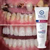 New Upgrade Quick Repair of Cavities Caries Removal of Plaque Stains Decay Whitening Yellowing Repair Teeth Teeth Whitening 2