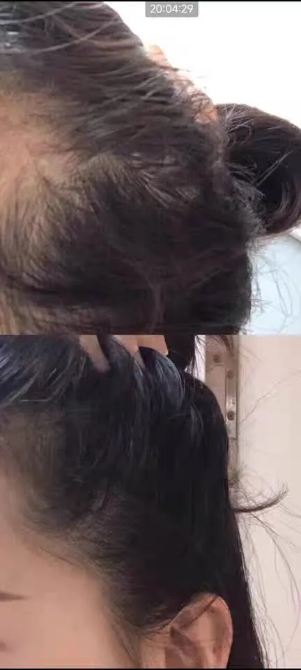 KräuterKraft Shampoo - Natürliche Stärkung für Ihr Haar