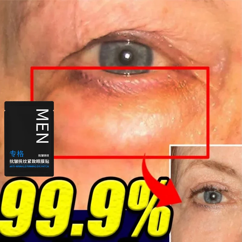 Collagen Eye Mask Eyes Bag Remove Instant Fade Fine Lines Dark Circles Fat Particles Moisturizing Anti-Puffiness Korea Eye Care