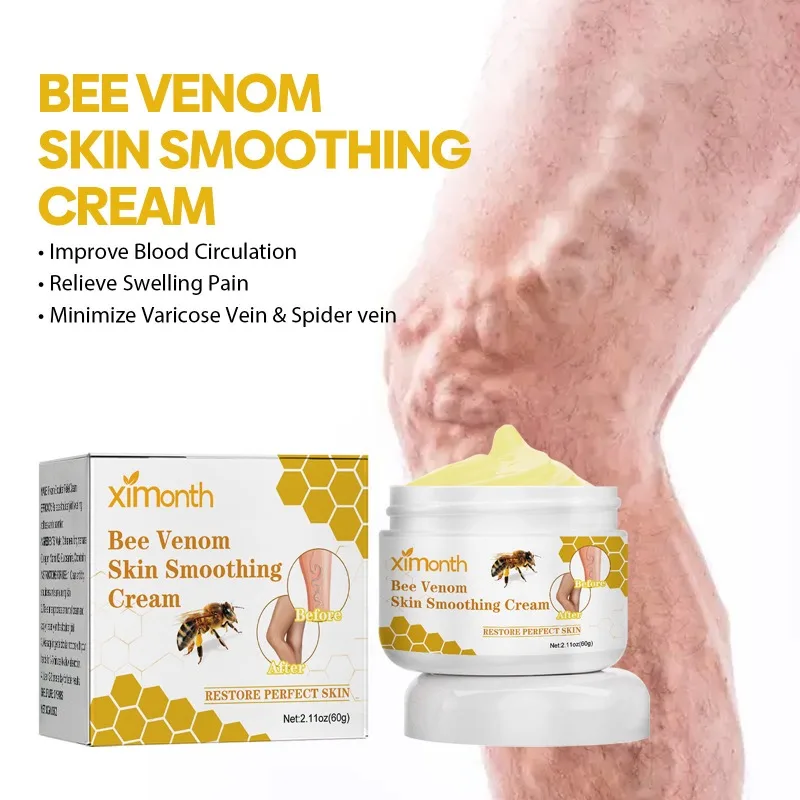 발톱무좀 Bee Venom Venous Repair Cream Relieves Leg Pain and Swelling Smoothes Vascular Protruding Veins Personal Health Care personal health care