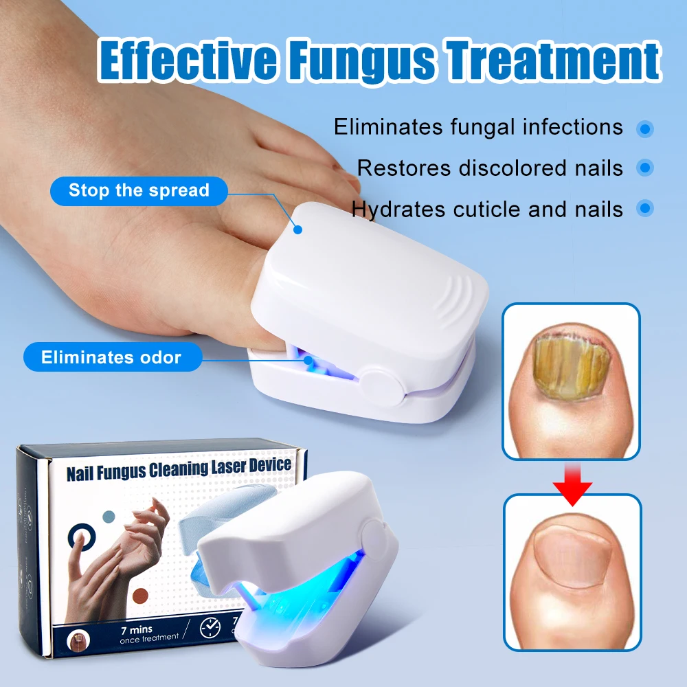 Nail Fungus Remover Nail Fungus Laser Treatment Device Repair Toenail Fingernail Fungus Treat Onychomycosis Laser Nails with Mushrooms Relaxation Laser Therapy Pen