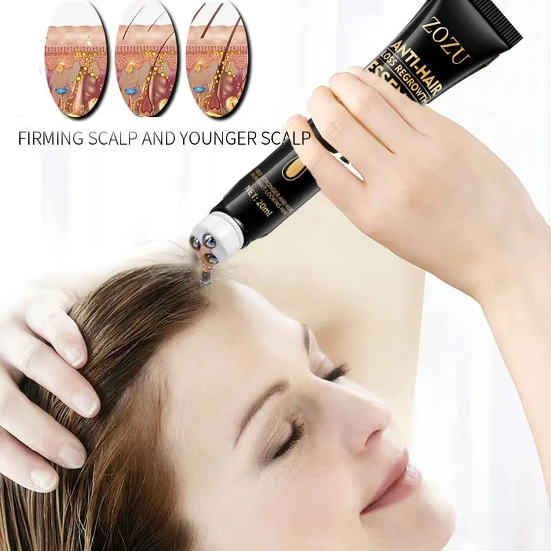 

Fast Hair Growth Essence Effective Anti Hair Loss Serum Baldness Repair Hereditary Postpartum Seborrheic Hair Loss Hair Care