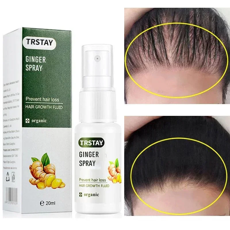 

Ginger Extract Hair Growth Spray Prevent Hair Loss Anti Frizzy Split Ends Breaks Nourish Hair Root Strengthen Smooth Hair Care