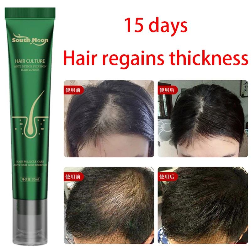 

Anti dropping dense hair essence hair care nutrient liquid massage hair root dense hair essence liquid