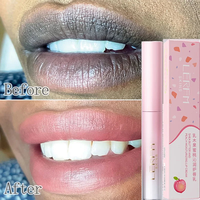 

Fast Lightening Pink Mouth Lips Serum Bleaching Remove Dark Smoke Lips Lip Balm Whiten Moisturizer Nourishing Essence Lip Care