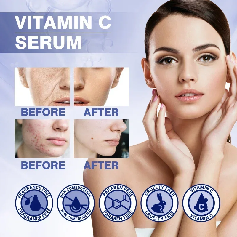 

Sdottor Anti-Aging Lightens fine lines Vitamin C Facial Serum Lift Firming Whitening Freckles Remove acne face moisturizes skin