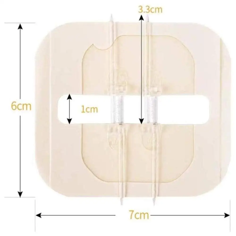 

Zipper Band-aid Painless Wound Closure Device Suture-free Wound Dressing Patches Zip Suture Reducer Band Aid 2022