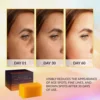 Kojic Acid Dark Spot Remover Whitening Soap Handmade Skin Care Deep Cleaning Moisturizing Cleansing Essential Soap Brighten Skin 5