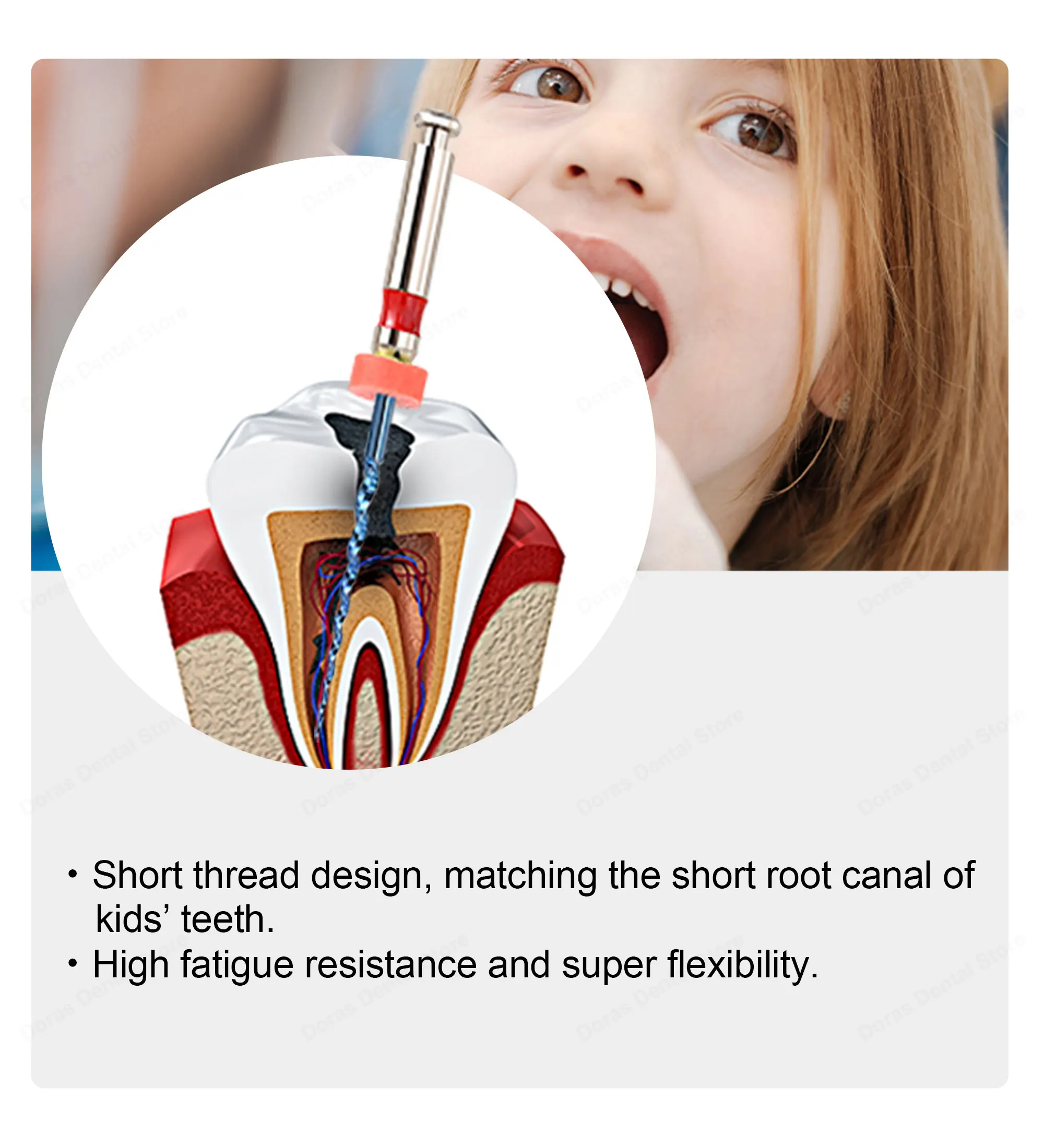 Lime dentali pediatriche movimento serpente niti per bambini_voghion.com