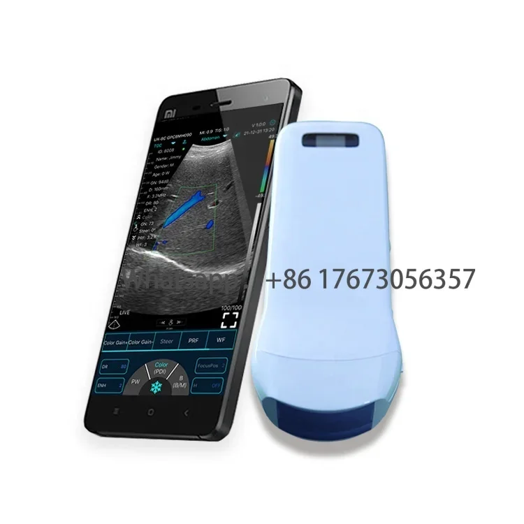 Ecografos De China Transduttore En 3D Y 4D Ecografo De Mano Ecografo Wireless