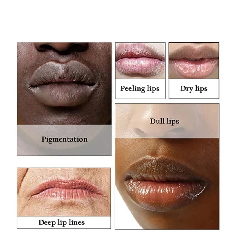 Lips Pink Fresh Lightening Bleaching Cream Treatment Remove Dark Smoke Lips Lip Balm Whitening Moisturizer Nourishing Essence