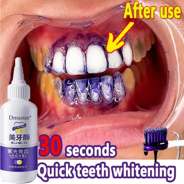 V34-roxo-creme-dental-clareamento-dos-dentes-enzima-remover-manchas-de-placa-higiene-oral-limpeza-ferramentas.jpg