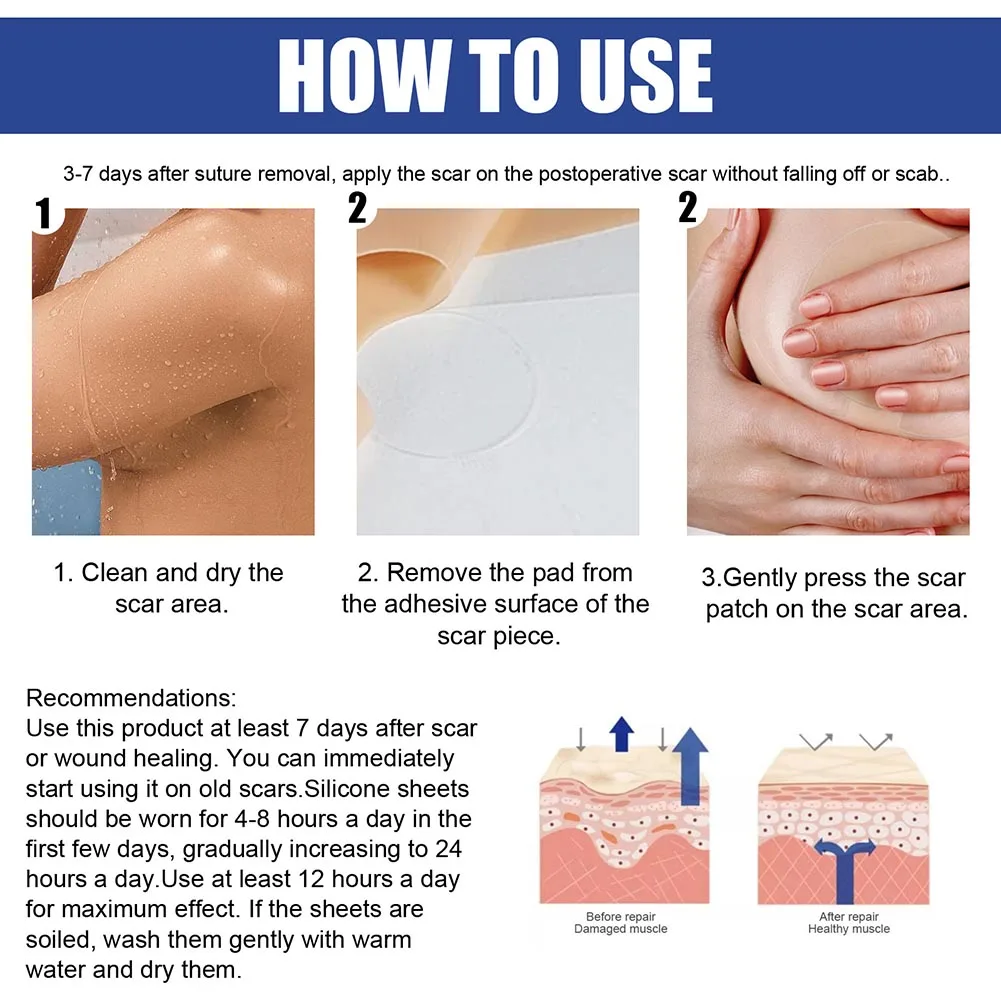 1Box Scar Removal Stickers Effective Silicone Acne Trauma Repair Sticker Comfortable To Use for Women Girls Skin Care Products